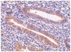 HAVCR1 Rabbit anti-Human, Mouse, Polyclonal Antibody, Abnova 100&mu;g;
