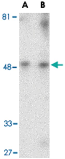 HAVCR1 Rabbit anti-Human, Mouse, Rat, Polyclonal Antibody, Abnova 100&mu;g;