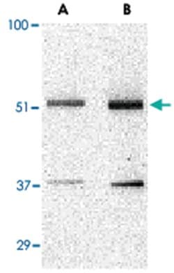 TANK Rabbit anti-Human, Polyclonal Antibody, Abnova 100 &mu;g | Buy Online | Abnova | Fisher Scientific