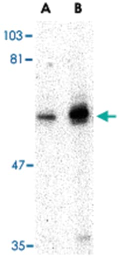 PTPN11 Rabbit anti-Human, Mouse, Rat, Polyclonal Antibody, Abnova 100&mu;g;