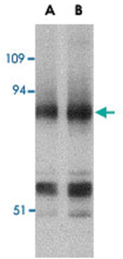 PRDM1 Rabbit anti-Human, Mouse, Rat, Polyclonal Antibody, Abnova 100&mu;g;