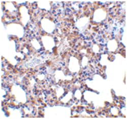 PRDM1 Rabbit anti-Human, Mouse, Rat, Polyclonal Antibody, Abnova 100&mu;g;