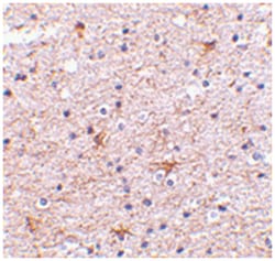 TMED10 Rabbit anti-Human, Mouse, Rat, Polyclonal Antibody, Abnova 100&mu;g;