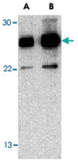 RPAIN Rabbit anti-Human, Mouse, Rat, Polyclonal Antibody, Abnova 100 &mu;g | Buy Online | Abnova | Fisher Scientific