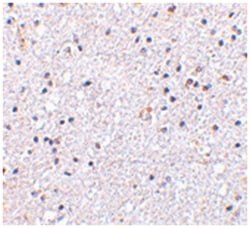 VISA Rabbit anti-Human, Mouse, Rat, Polyclonal Antibody, Abnova 100&mu;g;