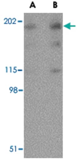 RTN4 Rabbit anti-Human, Mouse, Rat, Polyclonal Antibody, Abnova 100&mu;g;