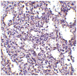 STIM2 Rabbit anti-Human, Mouse, Rat, Polyclonal Antibody, Abnova 100&mu;g;