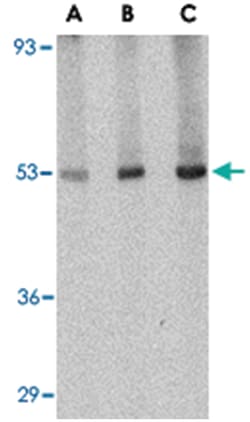CRLF2, Rabbit, Polyclonal Antibody, Abnova 50&mu;g; Unlabeled:Antibodies,