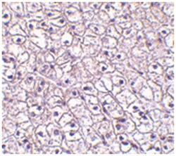 CRLF2, Rabbit, Polyclonal Antibody, Abnova 50&mu;g; Unlabeled:Antibodies,