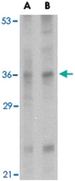 IL33 Rabbit anti-Human, Mouse, Rat, Polyclonal Antibody, Abnova 100 &mu;g | Buy Online | Abnova Corporation | Fisher Scientific