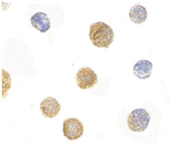 FYB Rabbit anti-Human, Mouse, Polyclonal Antibody, Abnova 100 &mu;g | Buy Online | Abnova | Fisher Scientific