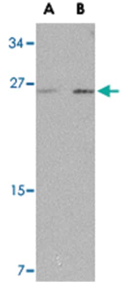 ARMET Rabbit anti-Human, Mouse, Rat, Polyclonal Antibody, Abnova 100 &mu;g | Buy Online | Abnova | Fisher Scientific