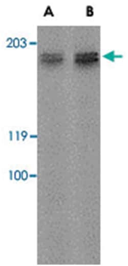 GPR124 Rabbit anti-Human, Rat, Polyclonal Antibody, Abnova 100&mu;g; Unlabeled:Antibodies,