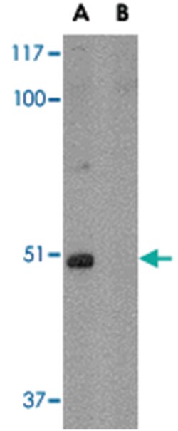 FNBP1L Rabbit anti-Human, Mouse, Rat, Polyclonal Antibody, Abnova 100 &mu;g | Buy Online | Abnova | Fisher Scientific