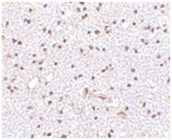 FNBP1L Rabbit anti-Human, Mouse, Rat, Polyclonal Antibody, Abnova 100 &mu;g | Buy Online | Abnova | Fisher Scientific