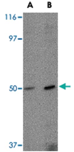 FEZ2 Rabbit anti-Human, Mouse, Rat, Polyclonal Antibody, Abnova 100&mu;g;