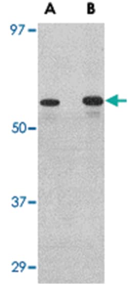 PLXDC2 Rabbit anti-Human, Mouse, Rat, Polyclonal Antibody, Abnova 100&mu;g;