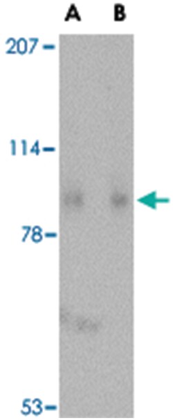 SLITRK1 Rabbit anti-Human, Mouse, Rat, Polyclonal Antibody, Abnova 100&mu;g;