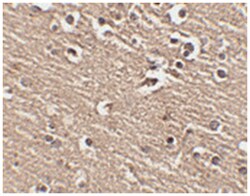 SLITRK1 Rabbit anti-Human, Mouse, Rat, Polyclonal Antibody, Abnova 100&mu;g;