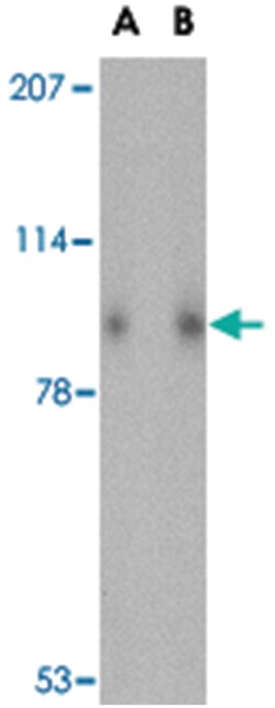 SLITRK1 Rabbit anti-Human, Mouse, Rat, Polyclonal Antibody, Abnova 100&mu;g;