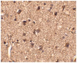 SLITRK1 Rabbit anti-Human, Mouse, Rat, Polyclonal Antibody, Abnova 100&mu;g;