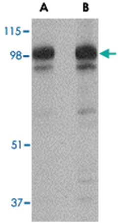 SLITRK2 Rabbit anti-Human, Mouse, Rat, Polyclonal Antibody, Abnova 100 &mu;g | Buy Online | Abnova | Fisher Scientific