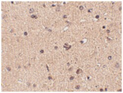 SLITRK2 Rabbit anti-Human, Mouse, Rat, Polyclonal Antibody, Abnova 100 &mu;g | Buy Online | Abnova | Fisher Scientific
