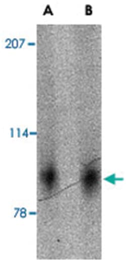 SLITRK2 Rabbit anti-Human, Mouse, Rat, Polyclonal Antibody, Abnova 100&mu;g;