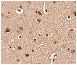SLITRK4 Rabbit anti-Human, Mouse, Rat, Polyclonal Antibody, Abnova 100&mu;g;
