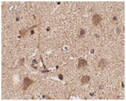SLITRK5 Rabbit anti-Human, Mouse, Rat, Polyclonal Antibody, Abnova 100&mu;g;