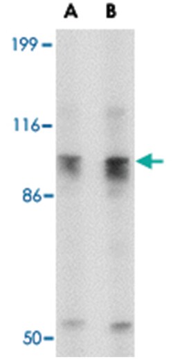 SLITRK6 Rabbit anti-Human, Mouse, Rat, Polyclonal Antibody, Abnova 100 &mu;g | Buy Online | Abnova | Fisher Scientific