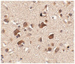 SLITRK6 Rabbit anti-Human, Mouse, Rat, Polyclonal Antibody, Abnova 100 &mu;g | Buy Online | Abnova | Fisher Scientific