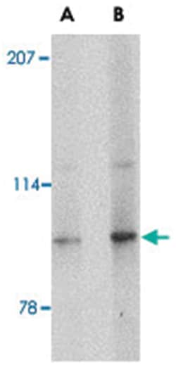 SLITRK4 Rabbit anti-Human, Mouse, Rat, Polyclonal Antibody, Abnova 100&mu;g;