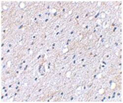 BAIAP3 Rabbit anti-Human, Polyclonal Antibody, Abnova 100&mu;g; Unlabeled:Antibodies,