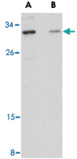 GRTP1 Rabbit anti-Human, Mouse, Rat, Polyclonal Antibody, Abnova 100&mu;g;