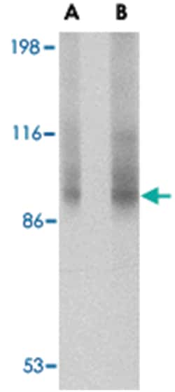TNPO3 Rabbit anti-Human, Mouse, Rat, Polyclonal Antibody, Abnova 100 &mu;g | Buy Online | Abnova Corporation | Fisher Scientific