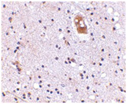 TMC8 Rabbit anti-Human, Mouse, Rat, Polyclonal Antibody, Abnova 100 &mu;g | Buy Online | Abnova | Fisher Scientific