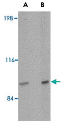 SATB2 Rabbit anti-Human, Mouse, Rat, Polyclonal Antibody, Abnova 100&mu;g;
