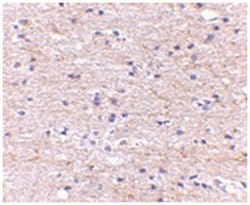 SATB2 Rabbit anti-Human, Mouse, Rat, Polyclonal Antibody, Abnova 100&mu;g;