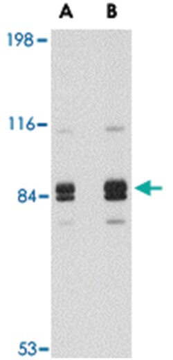 SNPH Rabbit anti-Human, Mouse, Rat, Polyclonal Antibody, Abnova 100&mu;g;