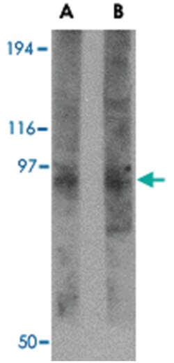 TMC8 Rabbit anti-Human, Mouse, Rat, Polyclonal Antibody, Abnova 100&mu;g;