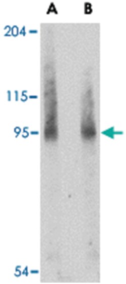 BICD2 Rabbit anti-Human, Mouse, Rat, Polyclonal Antibody, Abnova 100&mu;g;