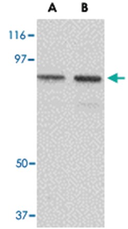 NUP107 Rabbit anti-Human, Rat, Polyclonal Antibody, Abnova 100 &mu;g | Buy Online | Abnova | Fisher Scientific