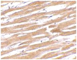 GP6 Rabbit anti-Human, Mouse, Rat, Polyclonal Antibody, Abnova 100 &mu;g | Buy Online | Abnova Corporation | Fisher Scientific