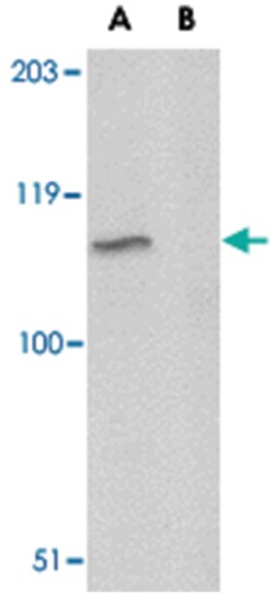 GP6 Rabbit anti-Human, Mouse, Rat, Polyclonal Antibody, Abnova 100 &mu;g | Buy Online | Abnova Corporation | Fisher Scientific