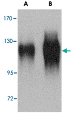 HIV gp120 Rabbit anti-Viruses, Polyclonal Antibody, Abnova 100&mu;g; Unlabeled:Antibodies,