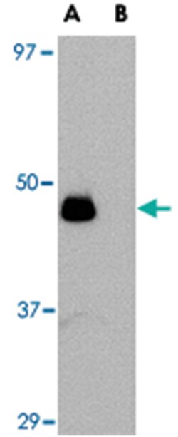 IL34 Rabbit anti-Human, Mouse, Rat, Polyclonal Antibody, Abnova 100&mu;g;