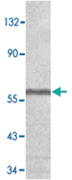 TNFRSF25 Rabbit anti-Human, Mouse, Polyclonal Antibody, Abnova 100&mu;g;