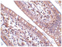 CIDEB Rabbit anti-Human, Mouse, Rat, Polyclonal Antibody, Abnova 100&mu;g;