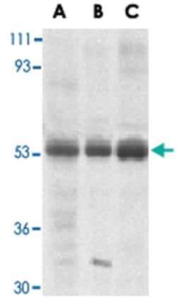 TRIM5 Rabbit anti-Human, Polyclonal Antibody, Abnova 100&mu;g; Unlabeled:Antibodies,